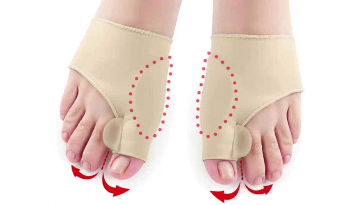 maxresdefault (10) Best Shoes for Hallux Valgus: Comfort and Support for Happy Feet